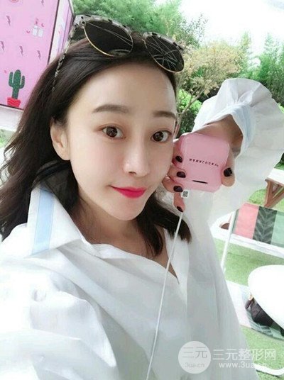 成都恒博发际线种植恢复过程分享