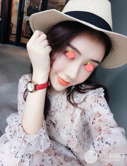 伊美尔王飏医生自体脂肪填充案例实记