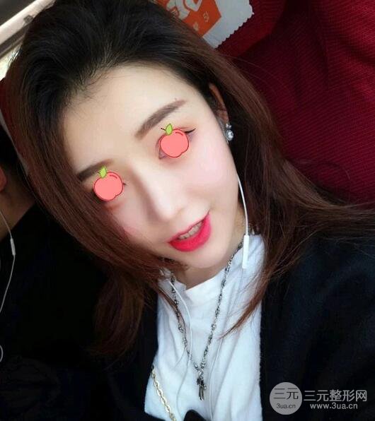 伊美尔王飏医生自体脂肪填充案例实记