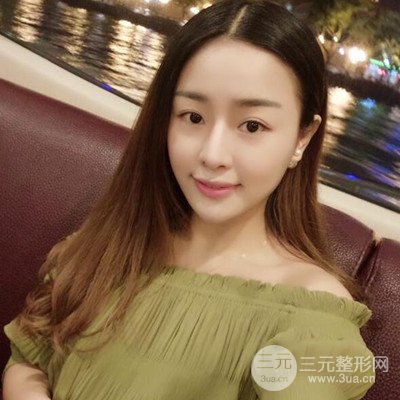 广州艺美李闯医生隆鼻整形恢复记录分享~