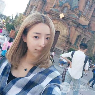 广州艺美李闯医生隆鼻整形恢复记录分享~