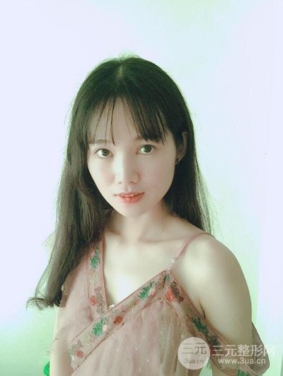 广州晨曦切开双眼皮恢复日记分享，附上前后对比图