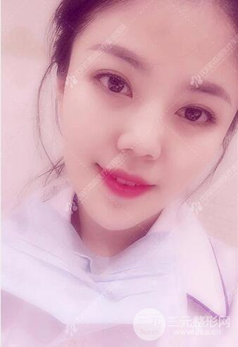 沈阳百嘉丽侯亚杰光纤溶脂瘦脸恢复日记