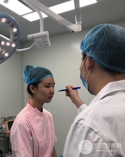 深圳蒳美迩朱灿自体脂肪填充日记分享