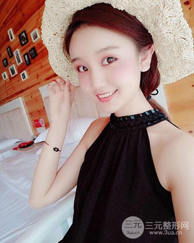 深圳蒳美迩朱灿自体脂肪填充日记分享