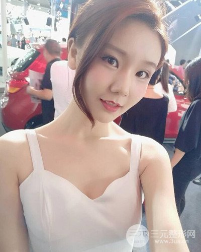 深圳蒳美迩朱灿自体脂肪填充日记分享