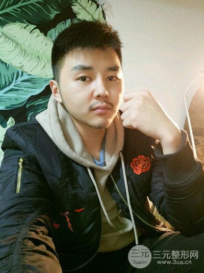 成都玉之光黄开亮医生隆鼻修复整形案例，前后恢复过程分享
