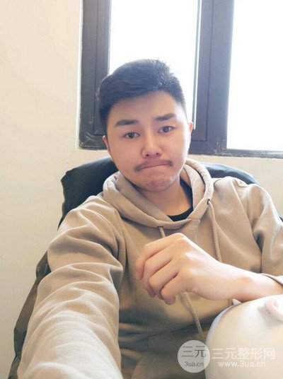 成都玉之光黄开亮医生隆鼻修复整形案例，前后恢复过程分享