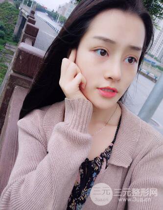 九院李青峰做鼻子的案例风格果图片分享