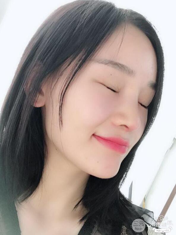 南京华美曹海峰隆鼻整形日记恢复图片分享~