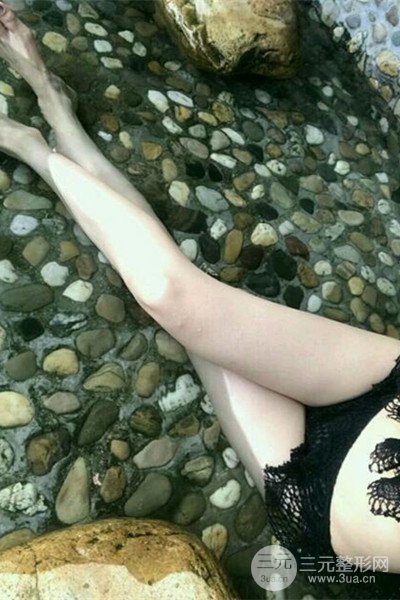 梨型身材做了大腿吸脂之后果超明X，吸脂恢复过程分享