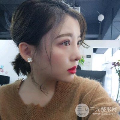 北京协和刘志飞隆鼻修复案例恢复过程日记分享