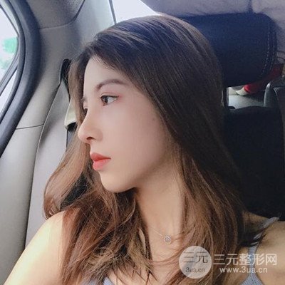 广州艺美隆鼻日记分享！前后对比图奉上！