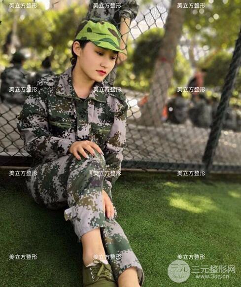 西安美立方李蓉华割双眼皮案例术后恢复日记