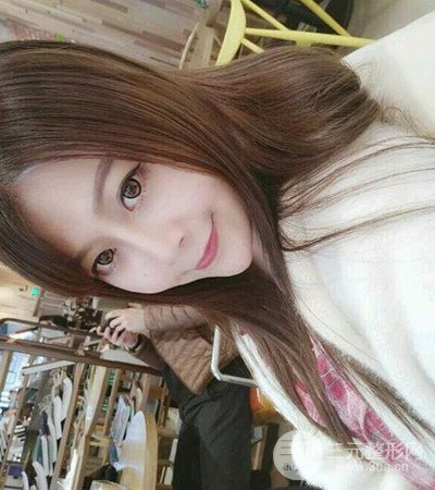 四川军大钟正强隆鼻案例日记分享