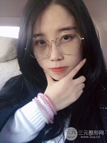 杭州艺之花杨海波整形医生双眼皮案例恢复日记