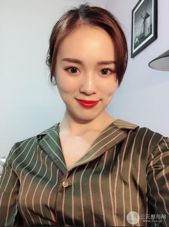 下颌角切除手术前后恢复对比图过程分享