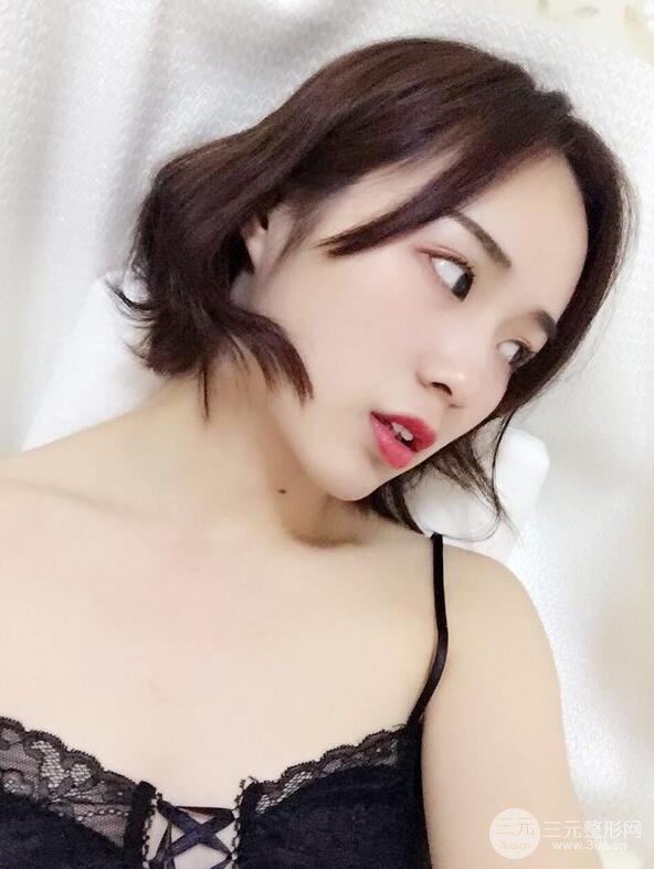 下颌角切除手术前后恢复对比图过程分享