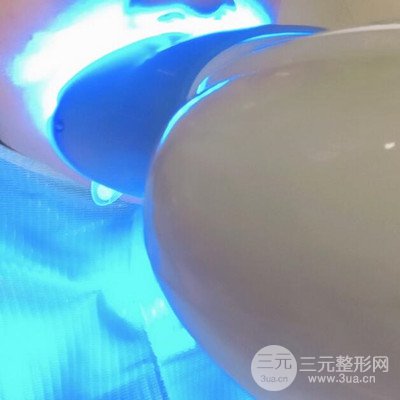 做了牙齿冷光美白果很棒，绽放美丽笑容