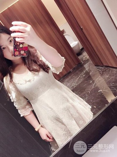 福州美贝尔吸脂案例分享