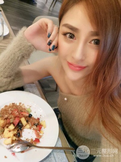 重庆铂生王振荣隆鼻整形前后对比图恢复过程分享