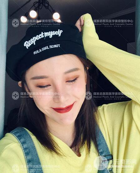 煤炭总医院整形美容科自体脂肪填充案例