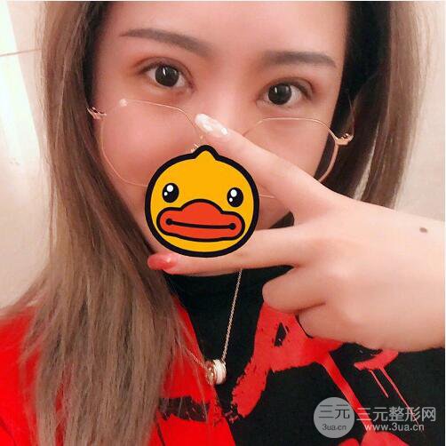 西安爱丁丁合军双眼皮整形案例日记