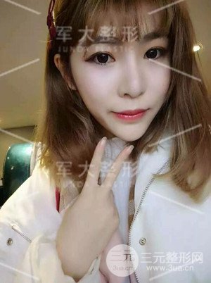 四川军大自体脂肪面部填充案例分享