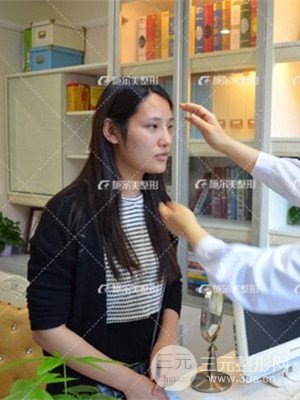 江苏施尔美自体脂肪填充面部案例，前后对比图分享