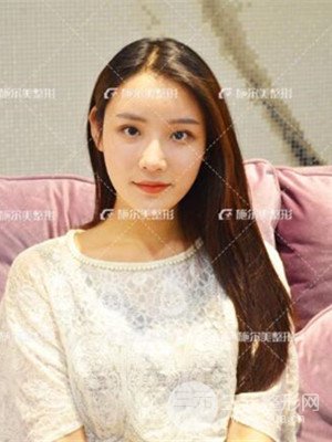江苏施尔美自体脂肪填充面部案例，前后对比图分享