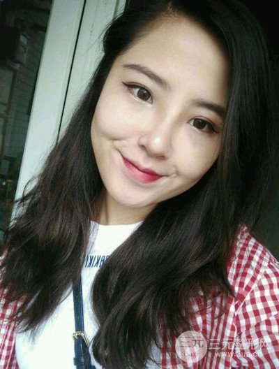 广州美莱李高峰隆鼻整形案例前后对比图分享~