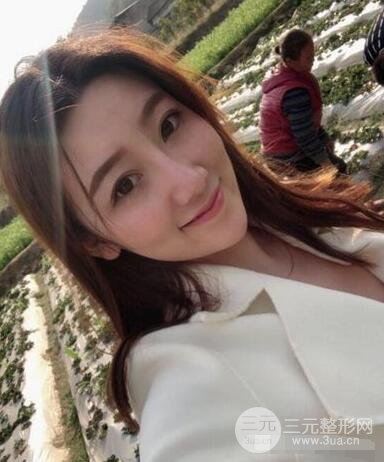 北京伊美尔徐军隆鼻整形前后对比照片心情记录小札