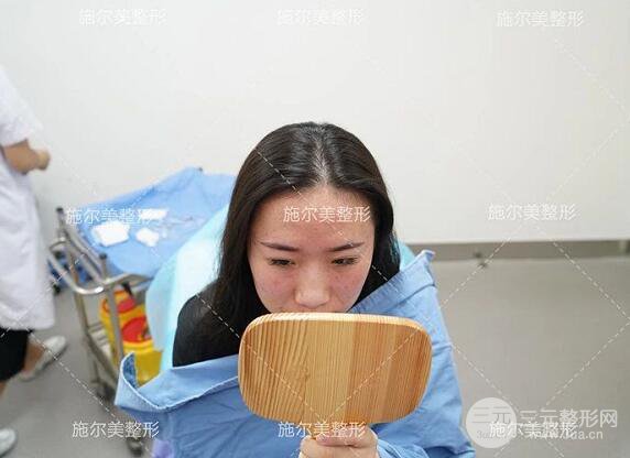 南京施尔美玻尿酸注射案例,让苹果肌嘭嘭嘭！