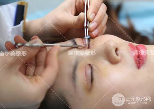 南京施尔美孙欣双眼皮案例果恢复图