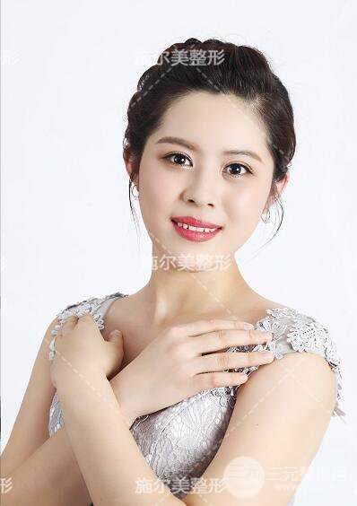 南京施尔美孙欣双眼皮案例果恢复图