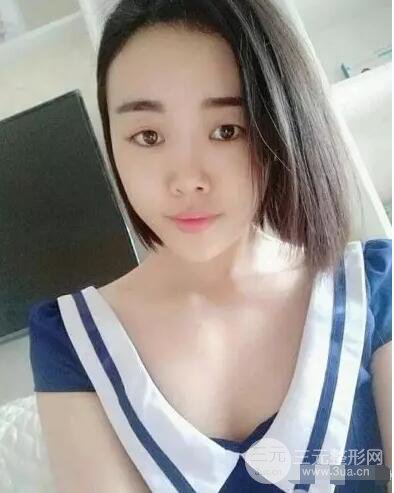 成都玉之光自体脂肪面部填充刘真人案例反馈|内附对比前后照