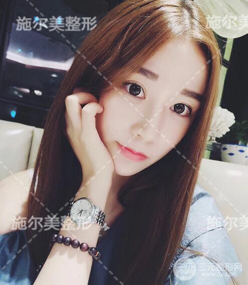 南京施尔美自体脂肪填充案例,拒绝“寿星公”！