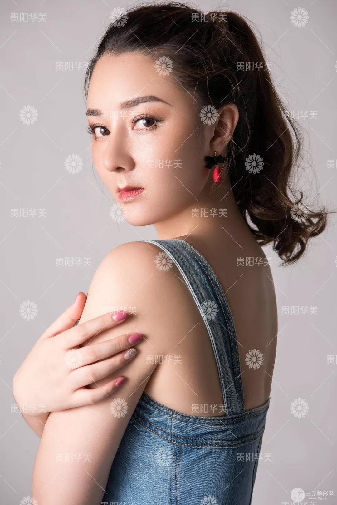 贵阳华美牛勇敢全切双眼皮+假体隆鼻案例前后对比图 华美员工全脸整形实录