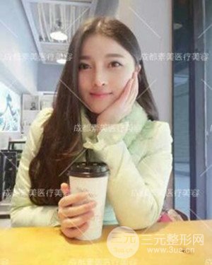 成都素美假体隆鼻案例前后对比图分享!