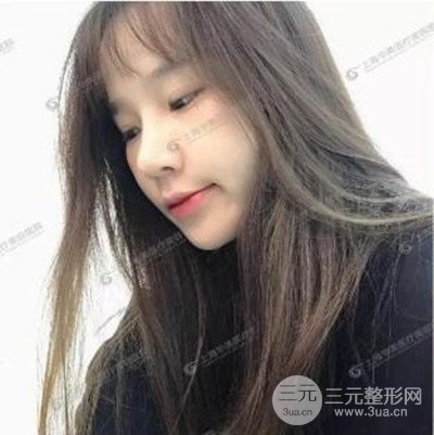 上海华美李志海隆鼻整形案例前后对比图分享~