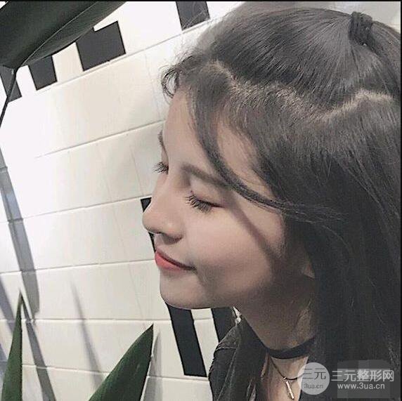 成都华西医院整形美容科卿勇隆鼻整形前后对比图恢复心情小札