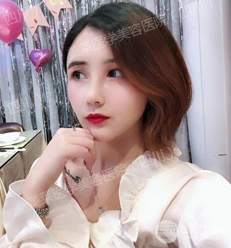 牛永敢医生隆鼻案例术后恢复记录详情