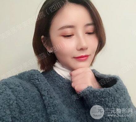 牛永敢医生隆鼻案例术后恢复记录详情