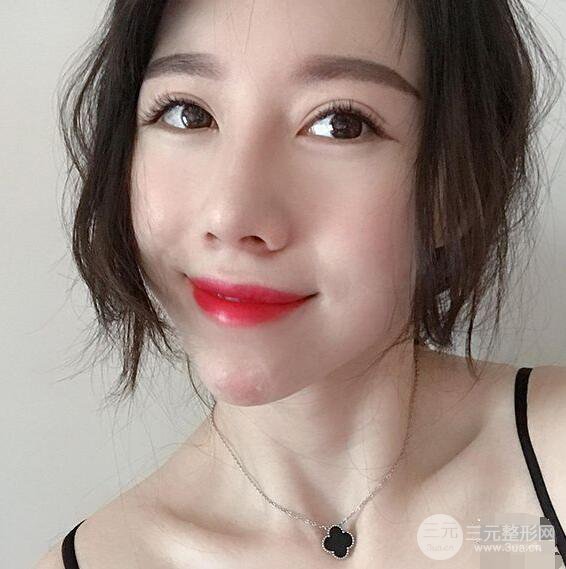 北京联合丽格吴焱秋耳软骨隆鼻前后对比图|塌鼻子的救星