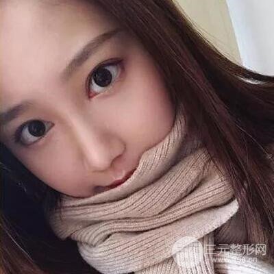 硅胶假体隆鼻案例前后对比图分享！颜值变化惊人！