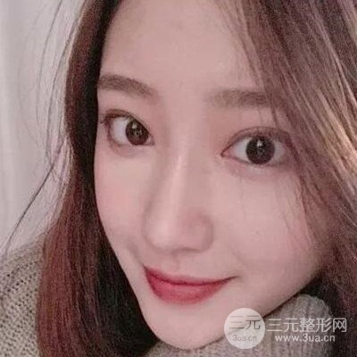 硅胶假体隆鼻案例前后对比图分享！颜值变化惊人！