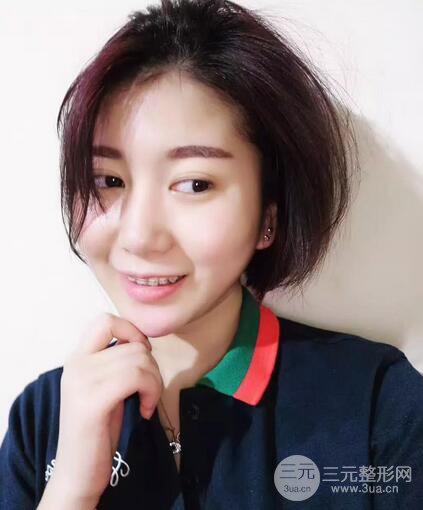 北京大学口腔医院牙齿矫正案例详情