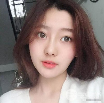 南京华美隆鼻整形前后对比图分享