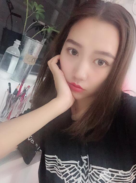 哈医大二院整形科肖志波全切双眼皮前后对比图 真实恢复经历日记