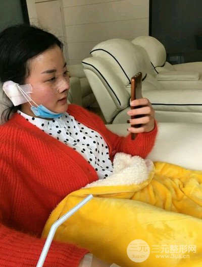 成都艾美薇魏东隆鼻整形手术前后恢复果图分享